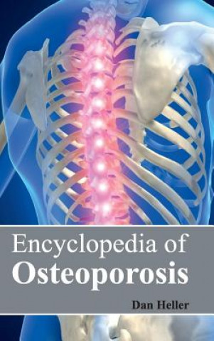 Carte Encyclopedia of Osteoporosis Dan Heller