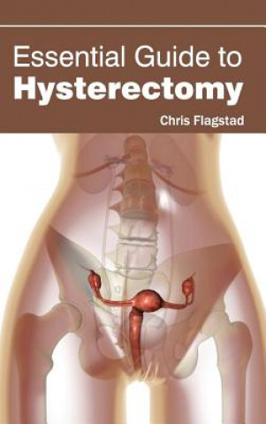 Kniha Essential Guide to Hysterectomy Chris Flagstad