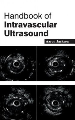 Carte Handbook of Intravascular Ultrasound Aaron Jackson