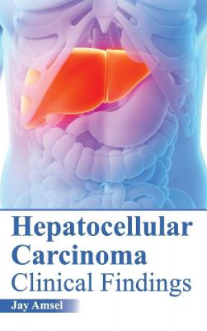 Knjiga Hepatocellular Carcinoma: Clinical Findings Jay Amsel