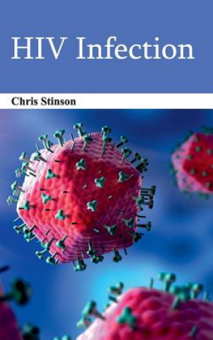 Kniha HIV Infection Chris Stinson