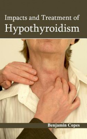 Könyv Impacts and Treatment of Hypothyroidism Benjamin Copes