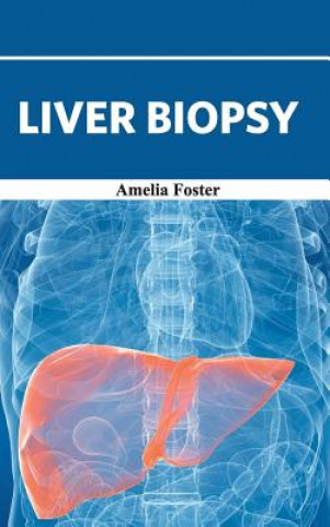 Kniha Liver Biopsy Amelia Foster