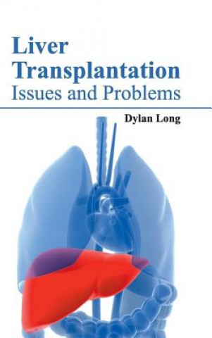 Knjiga Liver Transplantation: Issues and Problems Dylan Long