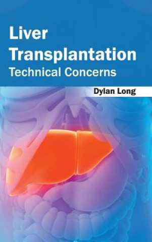 Książka Liver Transplantation: Technical Concerns Dylan Long