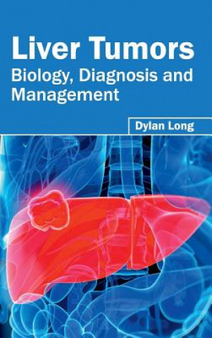 Knjiga Liver Tumors: Biology, Diagnosis and Management Dylan Long