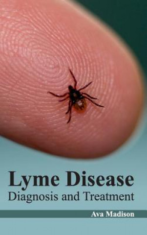 Könyv Lyme Disease: Diagnosis and Treatment Ava Madison