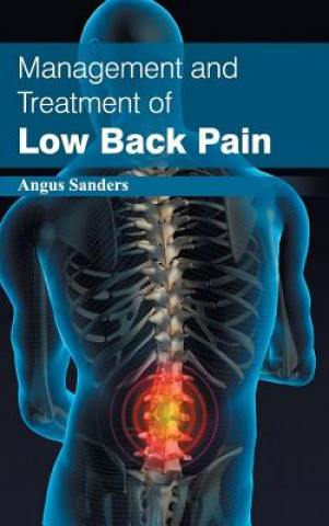 Kniha Management and Treatment of Low Back Pain Angus Sanders
