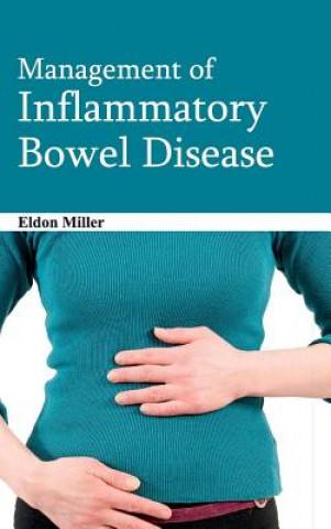 Kniha Management of Inflammatory Bowel Disease Eldon Miller