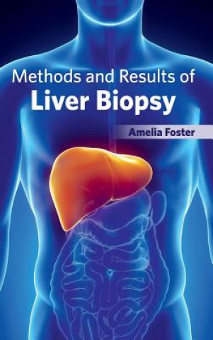 Книга Methods and Results of Liver Biopsy Amelia Foster