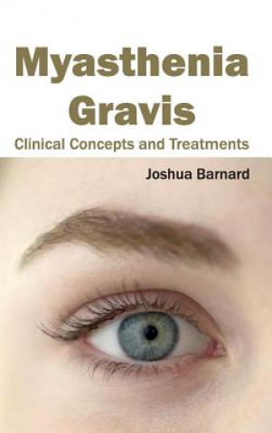 Könyv Myasthenia Gravis: Clinical Concepts and Treatments Joshua Barnard