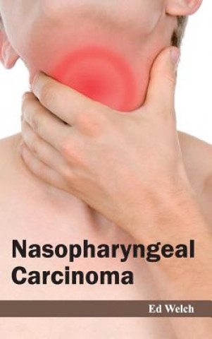 Книга Nasopharyngeal Carcinoma Ed Welch