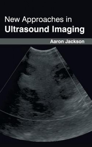 Kniha New Approaches in Ultrasound Imaging Aaron Jackson