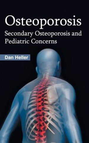Boek Osteoporosis: Secondary Osteoporosis and Pediatric Concerns Dan Heller