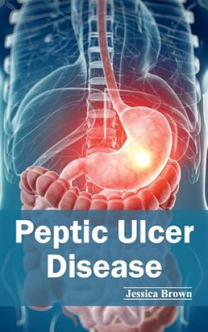 Könyv Peptic Ulcer Disease Jessica Brown