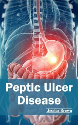 Buch Peptic Ulcer Disease Jessica Brown