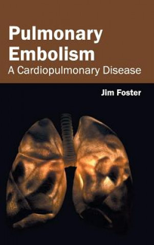 Knjiga Pulmonary Embolism: A Cardiopulmonary Disease Jim Foster