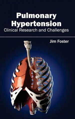 Buch Pulmonary Hypertension - Clinical Research and Challenges Jim Foster