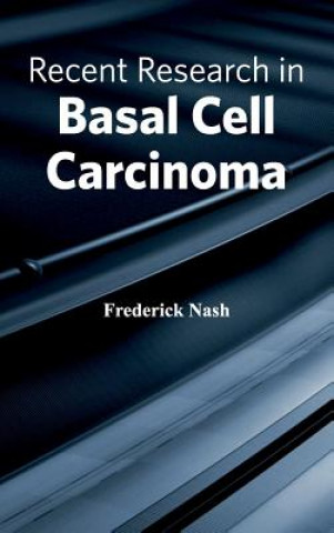 Kniha Recent Research in Basal Cell Carcinoma Frederick Nash