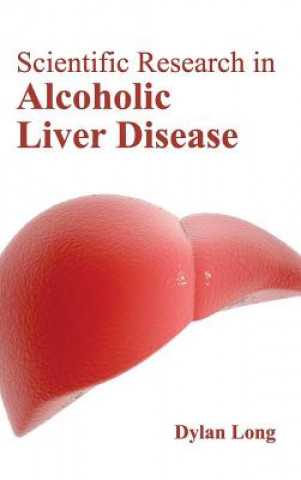 Kniha Scientific Research in Alcoholic Liver Disease Dylan Long