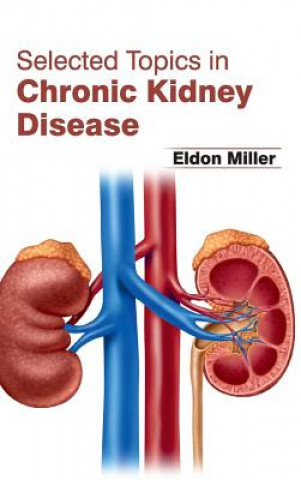 Carte Selected Topics in Chronic Kidney Disease Eldon Miller