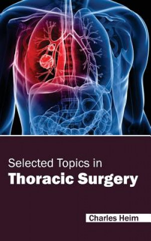 Carte Selected Topics in Thoracic Surgery Charles Heim