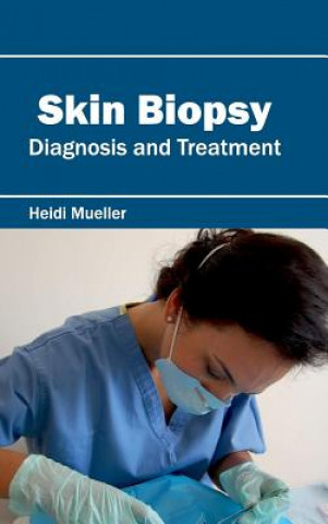 Buch Skin Biopsy: Diagnosis and Treatment Heidi Mueller
