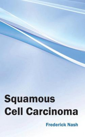 Kniha Squamous Cell Carcinoma Frederick Nash