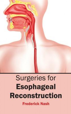 Książka Surgeries for Esophageal Reconstruction Frederick Nash