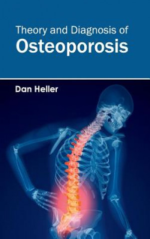 Книга Theory and Diagnosis of Osteoporosis Dan Heller