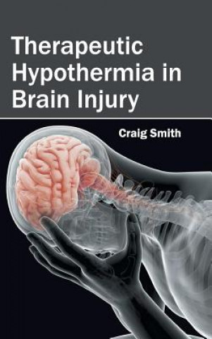 Könyv Therapeutic Hypothermia in Brain Injury Craig Smith