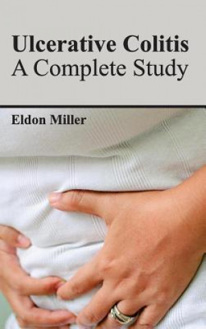 Kniha Ulcerative Colitis: A Complete Study Eldon Miller