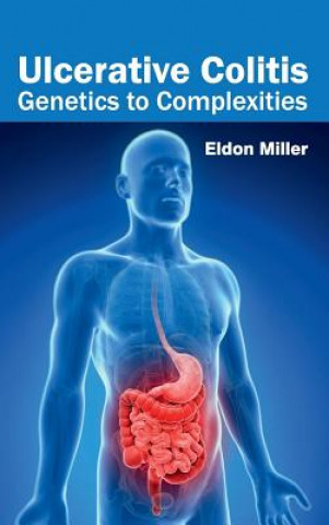 Könyv Ulcerative Colitis: Genetics to Complexities Eldon Miller