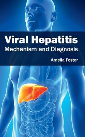 Könyv Viral Hepatitis: Mechanism and Diagnosis Amelia Foster