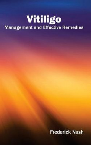 Könyv Vitiligo: Management and Effective Remedies Frederick Nash