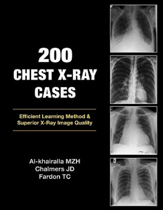 Könyv 200 Chest X-Ray Cases Mudher Al-Khairalla