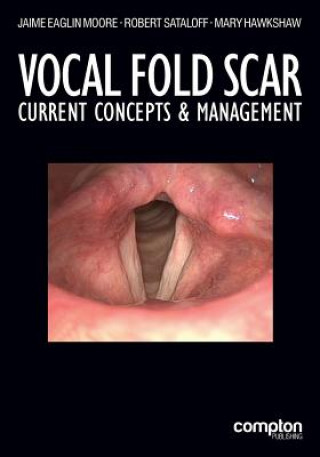 Kniha Vocal Fold Scar Jaime Eaglin Moore