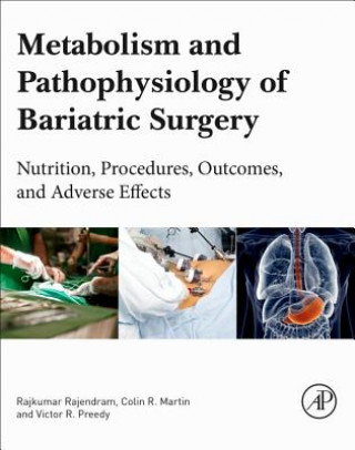 Carte Metabolism and Pathophysiology of Bariatric Surgery Rajkumar Rajendram