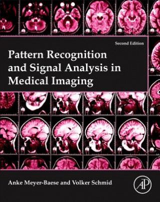 Carte Pattern Recognition and Signal Analysis in Medical Imaging Anke Meyer-Baese