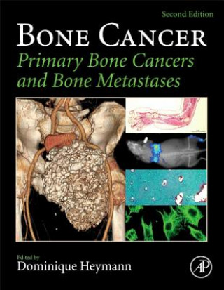 Knjiga Bone Cancer Dominique Heymann