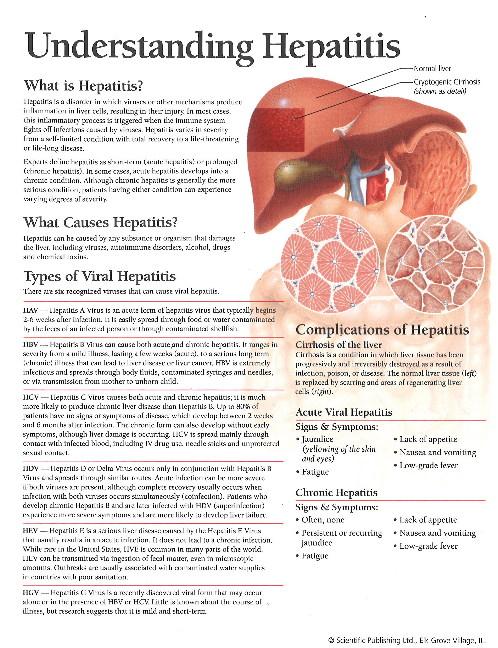 Kniha Understanding Hepatitis Model Scientific Publishing