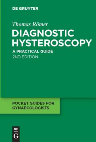 Knjiga Diagnostic Hysteroscopy Thomas Römer