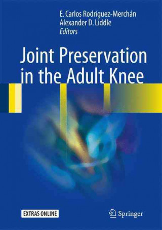 Könyv Joint Preservation in the Adult Knee E. Carlos Rodriguez-Merchan
