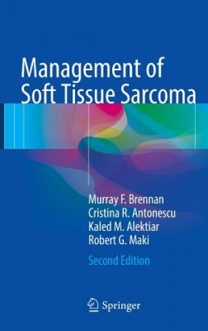 Könyv Management of Soft Tissue Sarcoma Murray Brennan