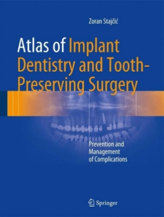 Könyv Atlas of Implant Dentistry and Tooth-Preserving Surgery Zoran Stajcic