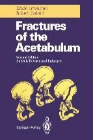 Carte Fractures of the Acetabulum Robert Judet