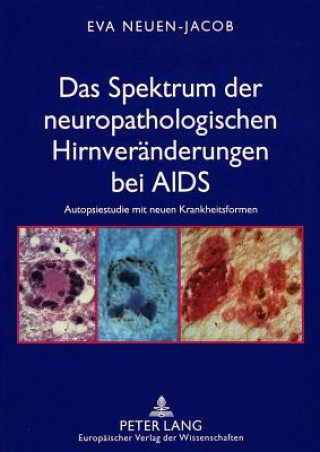 Könyv Das Spektrum der neuropathologischen Hirnveraenderungen bei AIDS Eva Neuen-Jacob