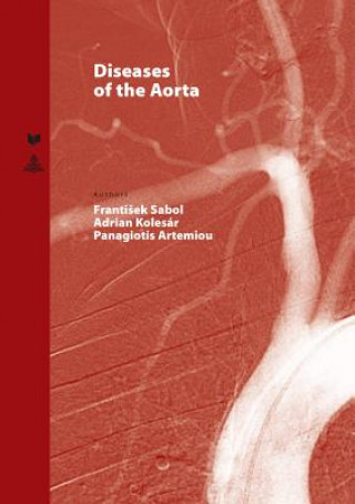 Carte Diseases of the Aorta Frantisek Sabol