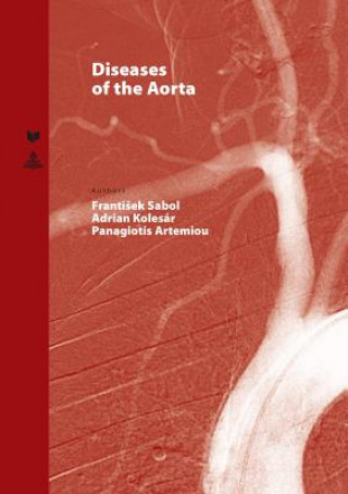 Book Diseases of the Aorta Frantisek Sabol