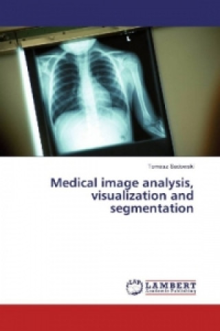 Buch Medical image analysis, visualization and segmentation Tomasz Sadowski